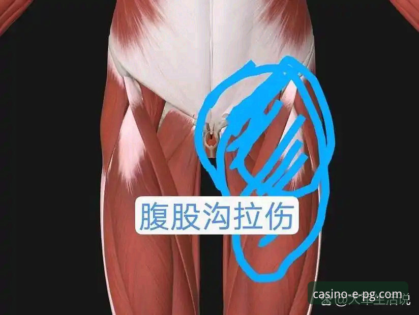 瑞典中场贝里瓦尔世预赛带伤作战最新动态：手术后三天韧带恢复，用腹股沟封堵射门